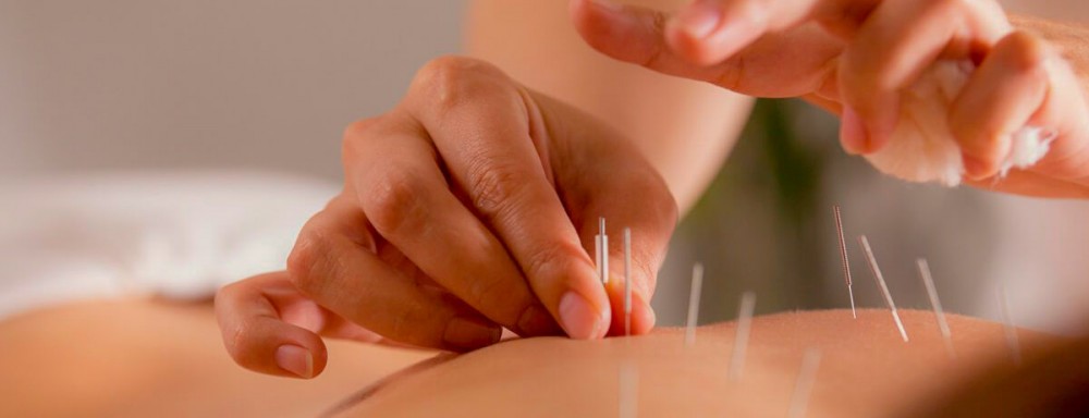 Acupuntura em Curitiba é na Japan Chiropractic Center!