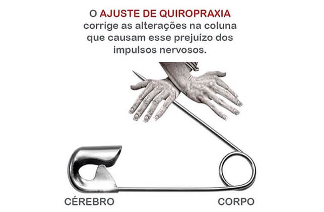 Exemplo Subluxação 4