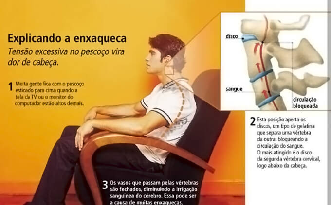 Tensão excessiva no pescoço vira dor de cabeça.